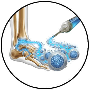 regenerative medicine